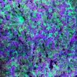 Colorful coral with purple and green polyps.